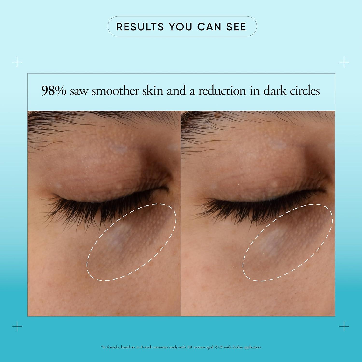 imagephilosophy dose of wisdom dark circle eye cream with hyaluronic acid vitamin C amp caffeine brigthens amp hydrates skin 05 fl oz