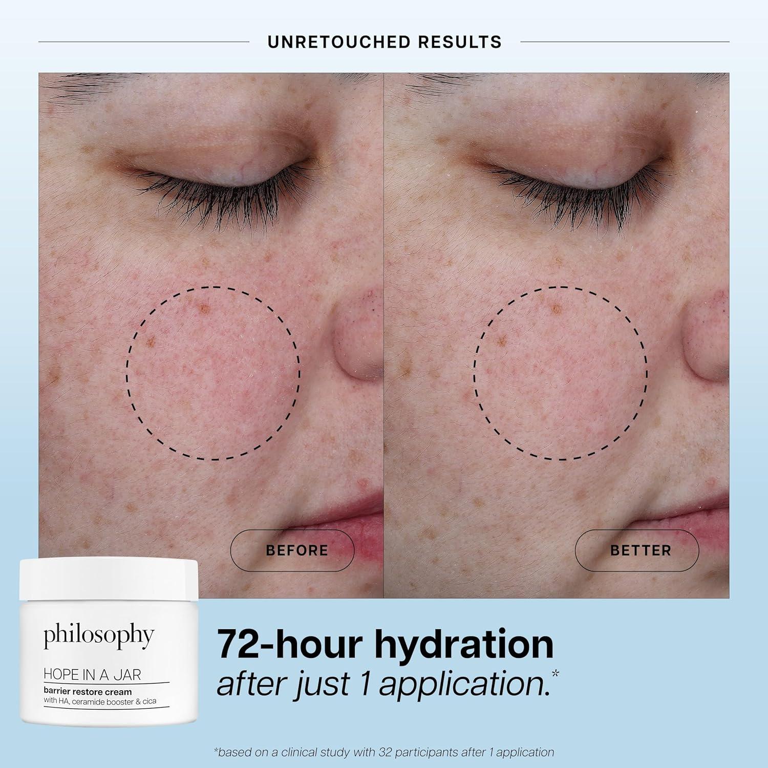 imagephilosophy hope in a jar barrier restore cream with ha complex cica amp ceramides intensely hydrating moisturizer for dry sensitive skin repairs amp soothes05 Fl Oz Pack of 1