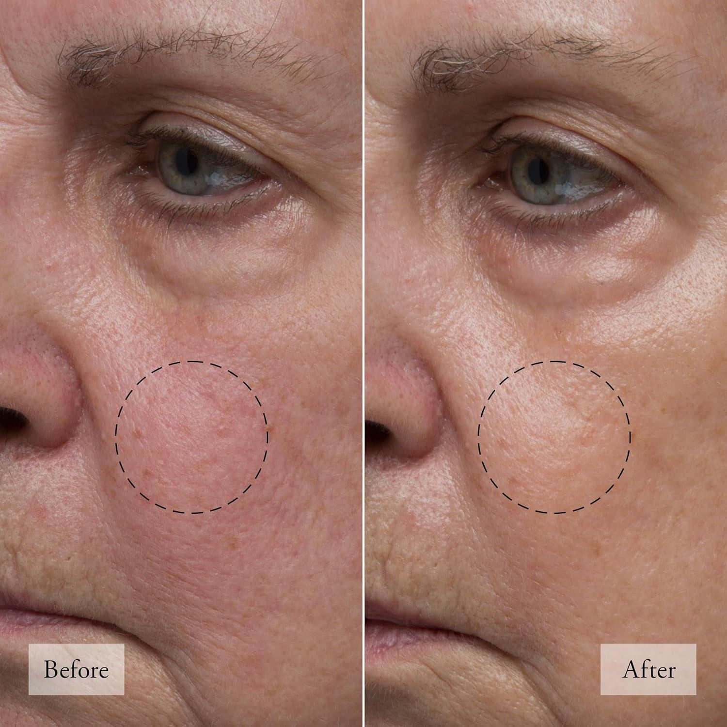 imagephilosophy hope in a jar skincare essentials mini set