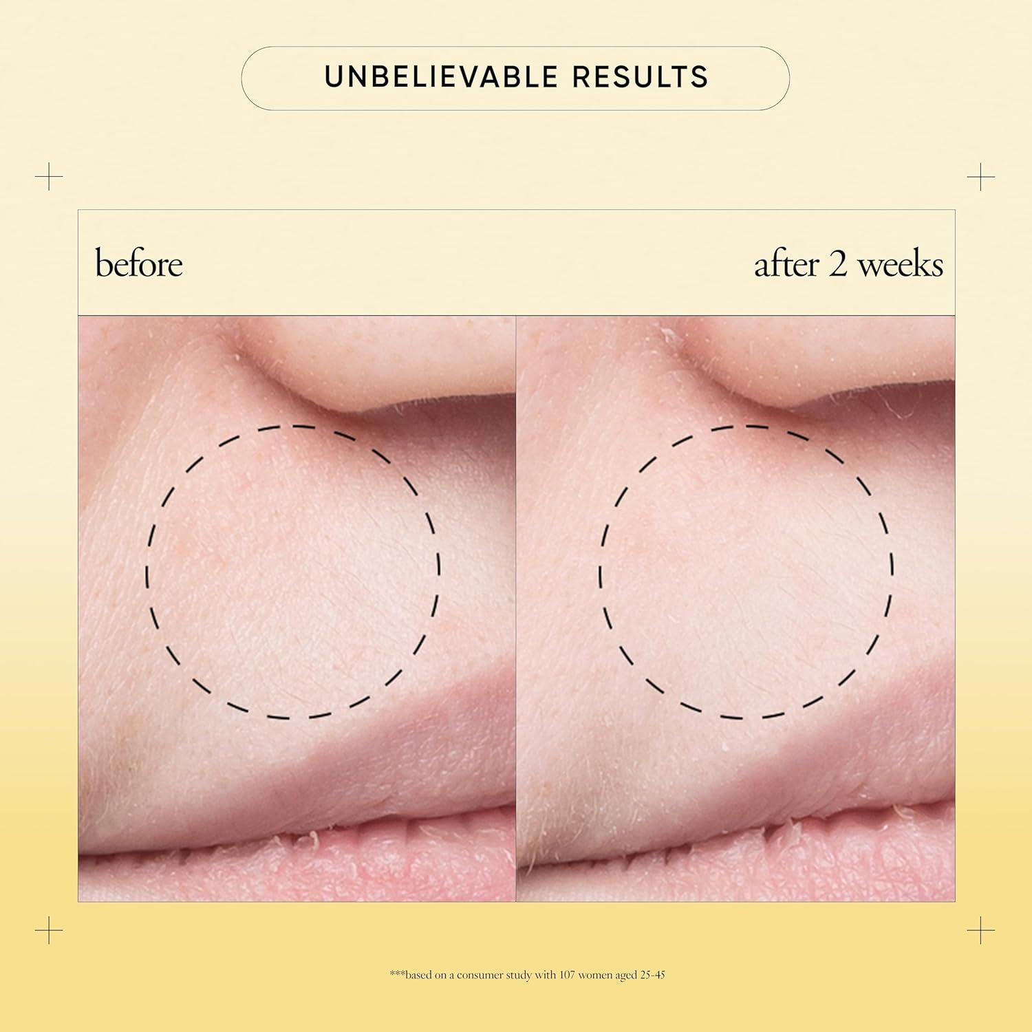 imagephilosophy purity made simple pore extractor clay face mask with purifying white kaolin clay salicylic acid amp natural exfoliants removes impurities and reduces the appearance of pores25 Fl Oz Pack of 1