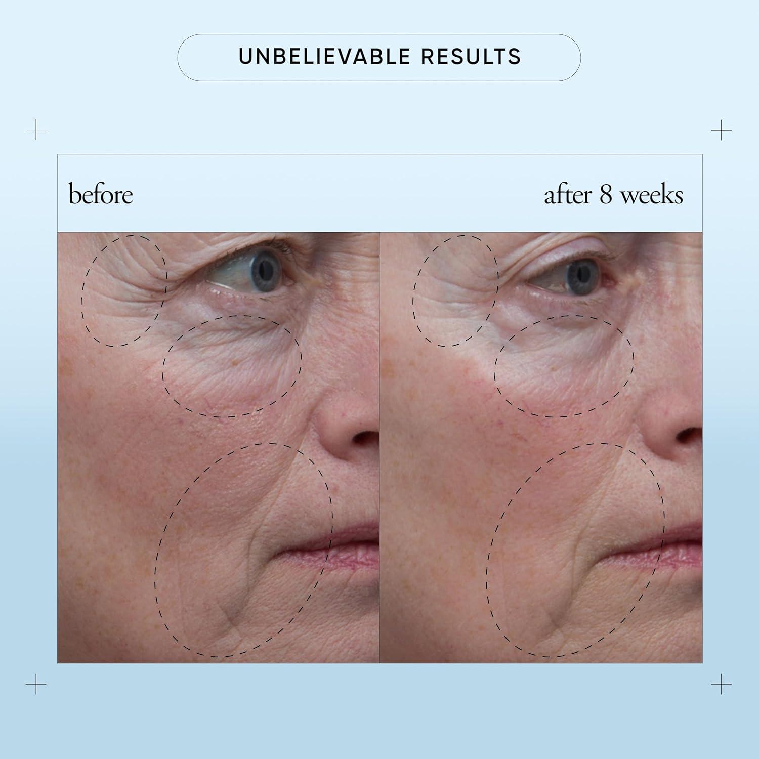 imagephilosophy when hope is not enough facial firming serum with vitamins C E amp hyaluronic acid revitalizes dull complexion while reducing the look of fine lines and wrinkles 1 fl oz